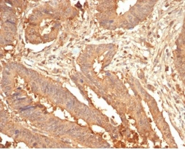 Galectin-3 (LGALS3) (Thyroid Cell Marker) Antibody in Immunohistochemistry (Paraffin) (IHC (P))