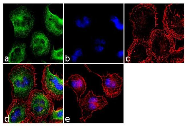 TACR1 Antibody in Immunocytochemistry (ICC/IF)