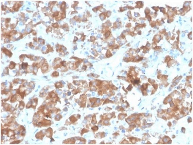 LH-beta (Luteinizing Hormone-beta) Antibody in Immunohistochemistry (Paraffin) (IHC (P))