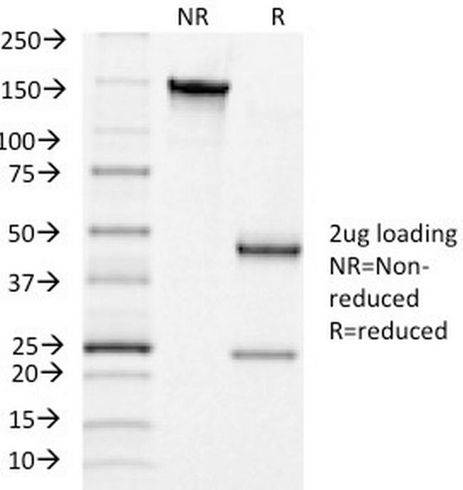 Luteinizing Hormone/Choriogonadotropin Receptor (LHCGR) Antibody in SDS-PAGE (SDS-PAGE)