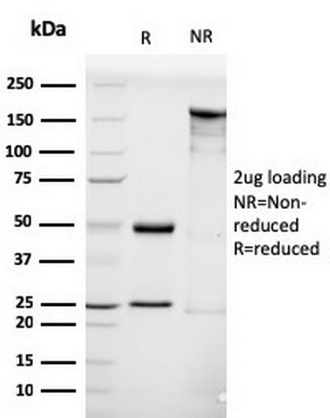 Luteinizing Hormone/Choriogonadotropin Receptor (LHCGR) Antibody in SDS-PAGE (SDS-PAGE)