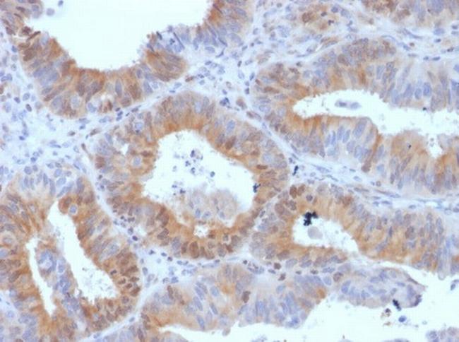 Luteinizing Hormone/Choriogonadotropin Receptor (LHCGR) Antibody in Immunohistochemistry (Paraffin) (IHC (P))