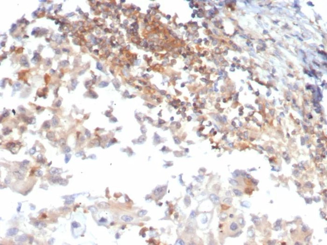 Luteinizing Hormone/Choriogonadotropin Receptor (LHCGR) Antibody in Immunohistochemistry (Paraffin) (IHC (P))