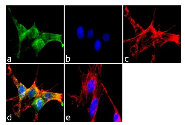 IkB alpha Antibody in Immunocytochemistry (ICC/IF)