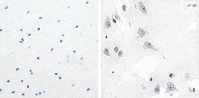 GSK3B Antibody in Immunohistochemistry (Paraffin) (IHC (P))