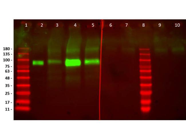 HER2 Fab Antibody in Western Blot (WB)