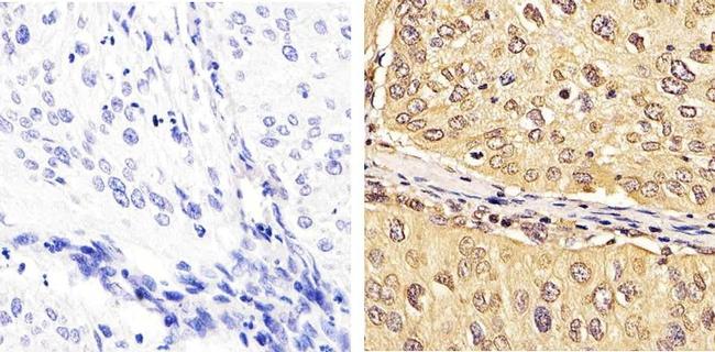 FBXW7 Antibody in Immunohistochemistry (Paraffin) (IHC (P))