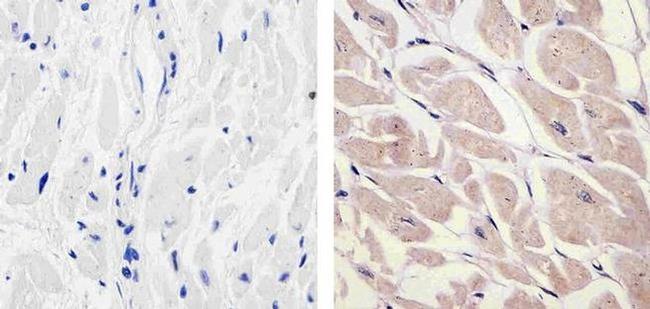 PDGF-D Antibody in Immunohistochemistry (Paraffin) (IHC (P))