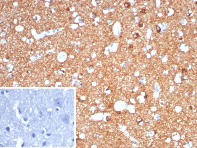 CD91/LDL Receptor Related Protein 1 (LRP1) Antibody in Immunohistochemistry (Paraffin) (IHC (P))