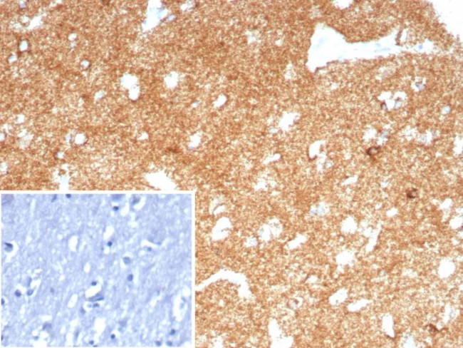 CD91/LDL Receptor Related Protein 1 (LRP1) Antibody in Immunohistochemistry (Paraffin) (IHC (P))