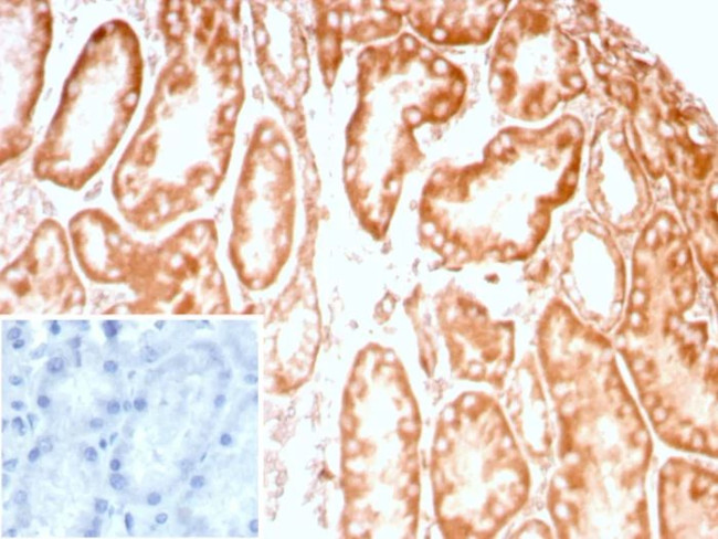 CD91/LDL Receptor Related Protein 1 (LRP1) Antibody in Immunohistochemistry (Paraffin) (IHC (P))