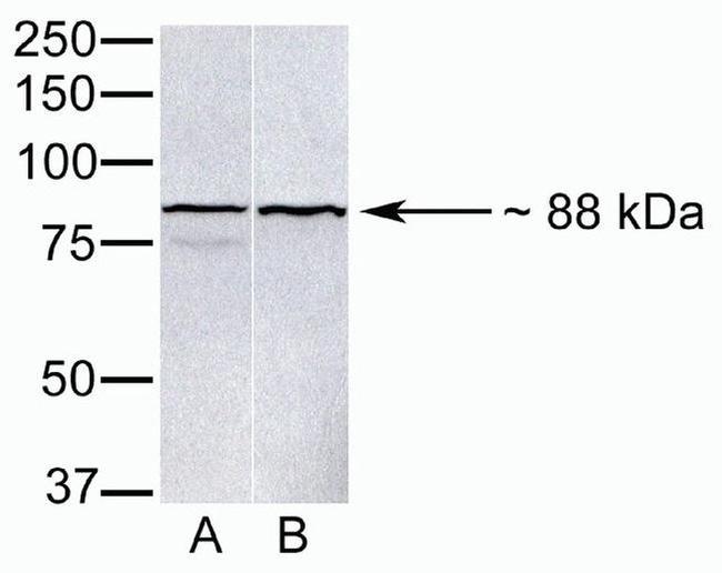 PARP9 Antibody in Western Blot (WB)