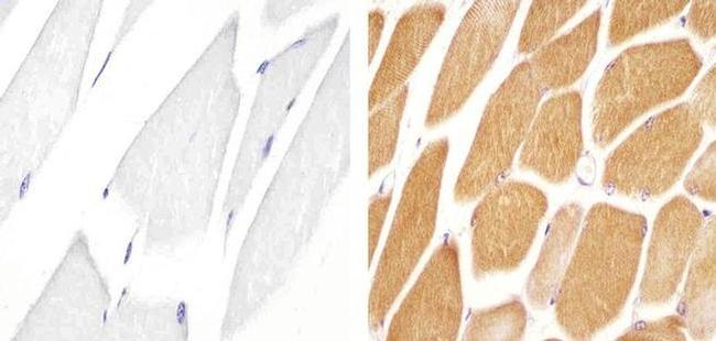 JPH1 Antibody in Immunohistochemistry (Paraffin) (IHC (P))