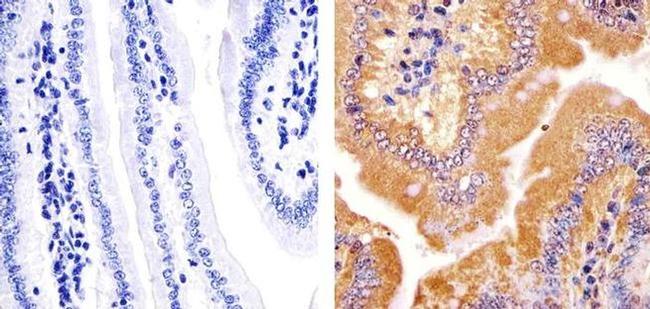 JPH2 Antibody in Immunohistochemistry (Paraffin) (IHC (P))