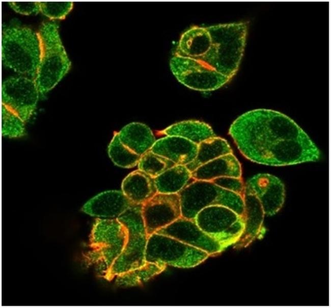 Lactotransferrin/Lactoferrin/LTF Antibody in Immunocytochemistry (ICC/IF)