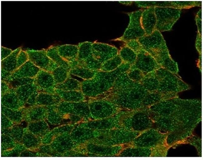 Lactotransferrin/Lactoferrin/LTF Antibody in Immunocytochemistry (ICC/IF)