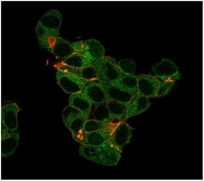 Lactotransferrin/Lactoferrin/LTF Antibody in Immunocytochemistry (ICC/IF)