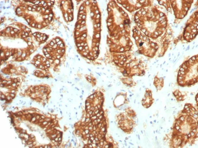 TACSTD2/TROP2 (Epithelial Marker) Antibody in Immunohistochemistry (Paraffin) (IHC (P))