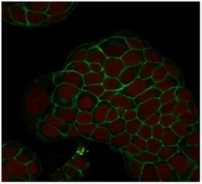 Ep-CAM/CD326 (Extracellular Domain) (Epithelial Marker) Antibody in Immunocytochemistry (ICC/IF)