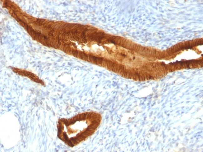 EpCAM/CD326 (Epithelial Marker) Antibody in Immunohistochemistry (Paraffin) (IHC (P))