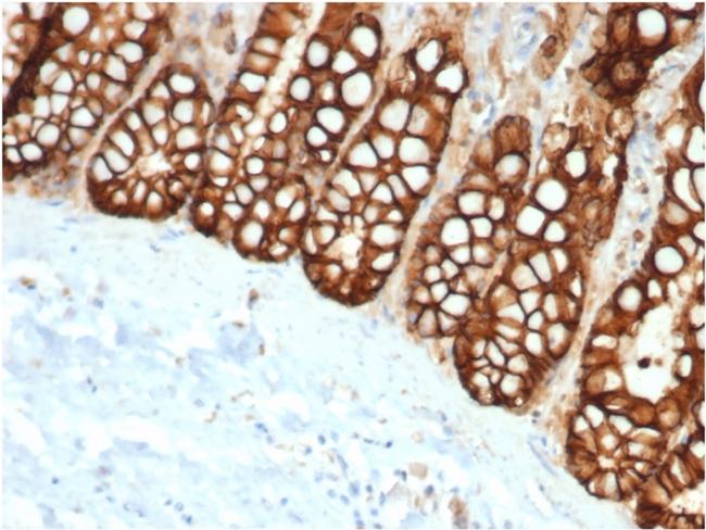 Ep-CAM/CD326 Antibody in Immunohistochemistry (Paraffin) (IHC (P))