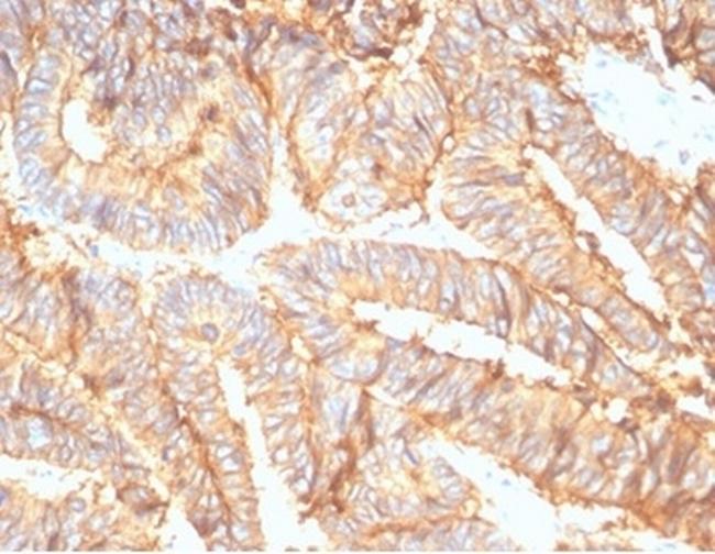 EpCAM/CD326 (Epithelial Marker) Antibody in Immunohistochemistry (Paraffin) (IHC (P))