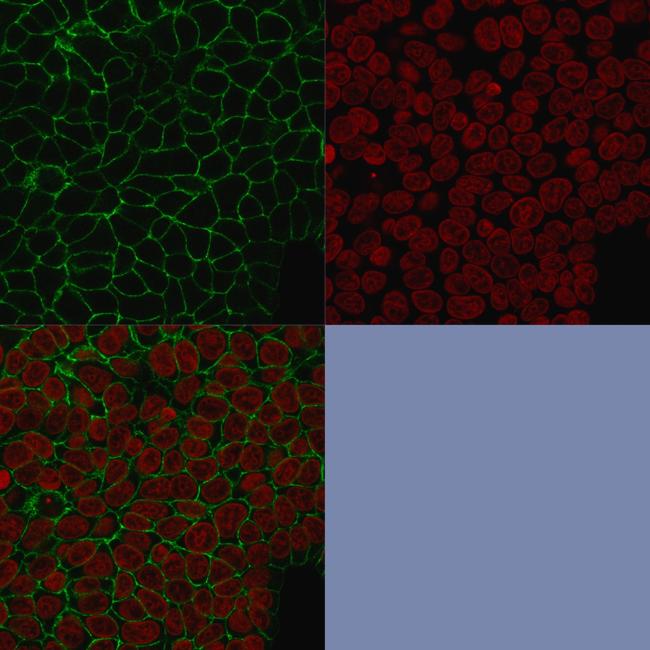 Ep-CAM/CD326 (Epithelial Marker) Antibody in Immunocytochemistry (ICC/IF)