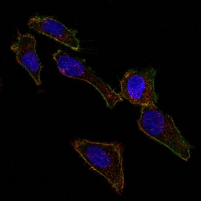 Ep-CAM/CD326 (Extracellular Domain) (Epithelial Marker) Antibody in Immunocytochemistry (ICC/IF)