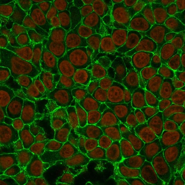 Ep-CAM/CD326 Antibody in Immunocytochemistry (ICC/IF)