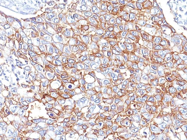 EpCAM/CD326 (Epithelial Marker) Antibody in Immunohistochemistry (Paraffin) (IHC (P))