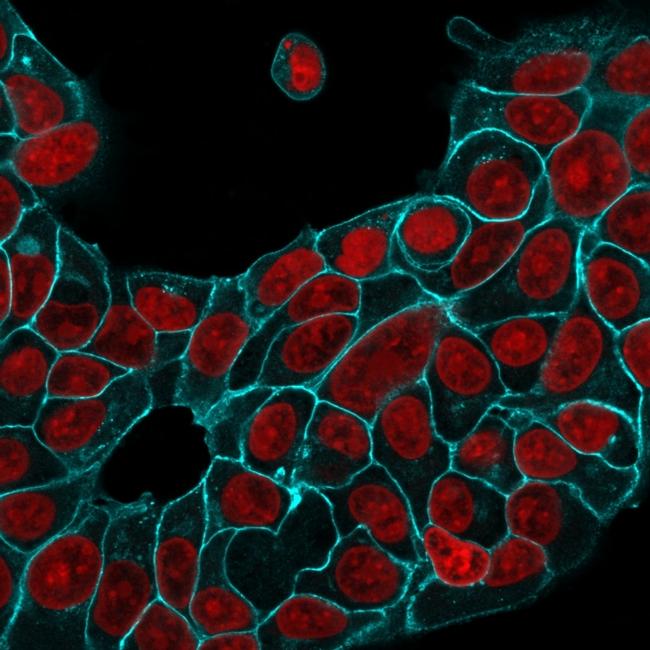 Ep-CAM/CD326 Antibody in Immunocytochemistry (ICC/IF)