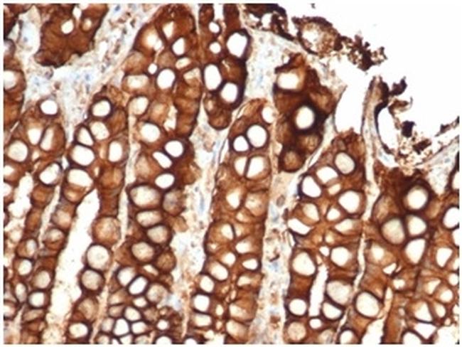 Ep-CAM/CD326 Antibody in Immunohistochemistry (Paraffin) (IHC (P))