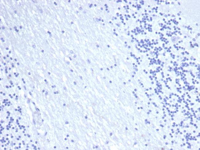 EpCAM/CD326 Antibody in Immunohistochemistry (Paraffin) (IHC (P))