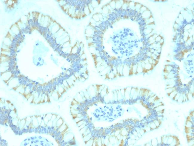 SMAD4 (Pancreatic Adenocarcinoma Marker) Antibody in Immunohistochemistry (Paraffin) (IHC (P))