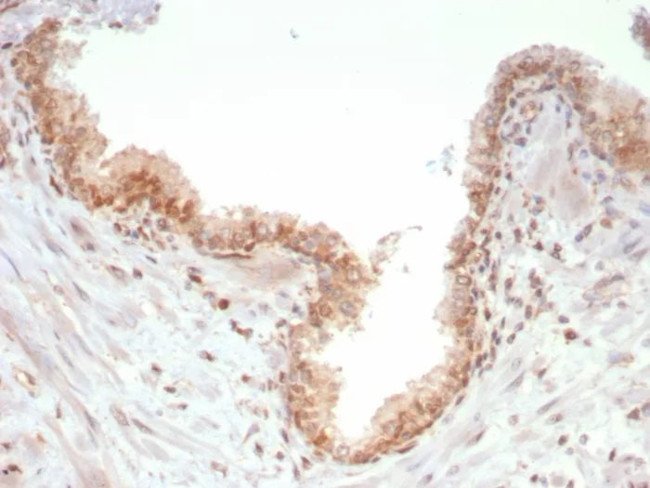 SMAD4 (Pancreatic Adenocarcinoma Marker) Antibody in Immunohistochemistry (Paraffin) (IHC (P))