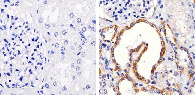 JAM3 Antibody in Immunohistochemistry (Paraffin) (IHC (P))