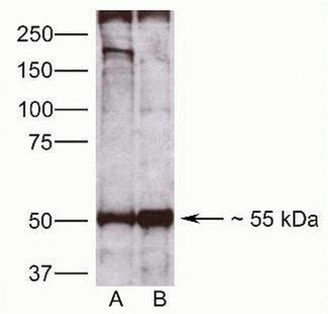 CDw293 Antibody in Western Blot (WB)