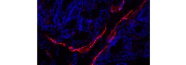 LYVE1 Antibody in Immunohistochemistry (Frozen) (IHC (F))