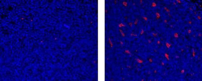 CD68 Antibody in Immunohistochemistry (Paraffin) (IHC (P))