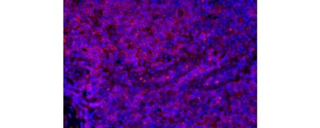 CD4 Antibody in Immunohistochemistry (Paraffin) (IHC (P))