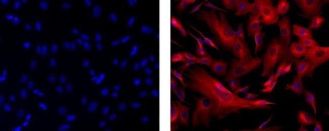 beta-3 Tubulin Antibody in Immunocytochemistry (ICC/IF)