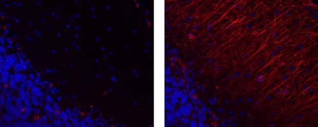 Mouse IgG1 kappa Isotype Control in Immunohistochemistry (Paraffin) (IHC (P))