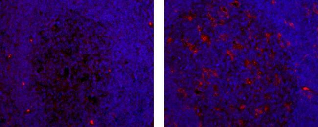 Mouse IgG2b kappa Isotype Control in Immunohistochemistry (Paraffin) (IHC (P))