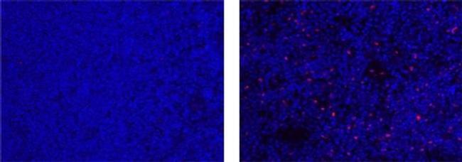 FOXP3 Antibody in Immunohistochemistry (Paraffin) (IHC (P))