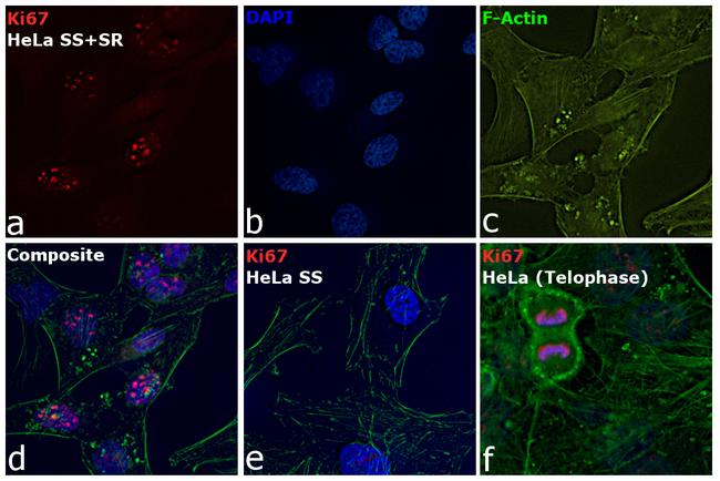 Ki-67 Antibody in Immunocytochemistry (ICC/IF)