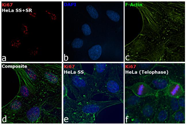 Ki-67 Antibody in Immunocytochemistry (ICC/IF)