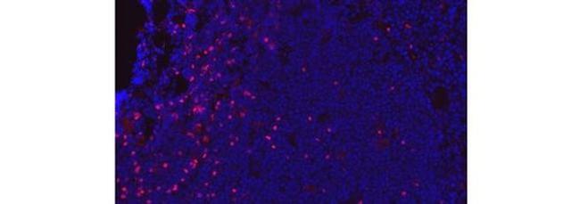 FOXP3 Antibody in Immunohistochemistry (Frozen) (IHC (F))