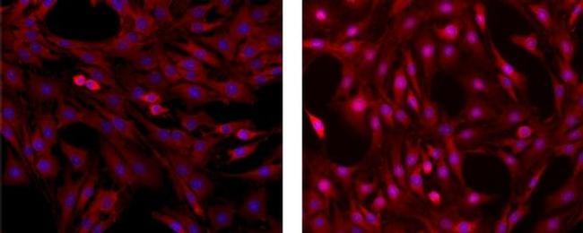 ERK1/2 Antibody in Immunocytochemistry (ICC/IF)