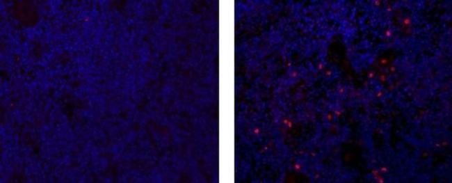 AIRE Antibody in Immunohistochemistry (Paraffin) (IHC (P))