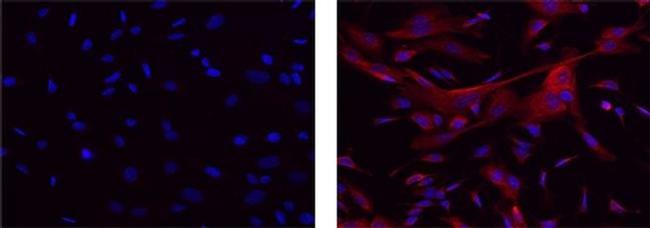 APP (Amyloid Precursor Protein) Antibody in Immunocytochemistry (ICC/IF)